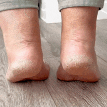 Lima Eléctrica para Pies